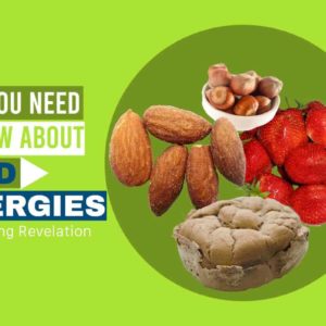 What You Need To Know About Food Allergies