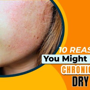 10 Reasons You Might Have Chronically Dry Skin