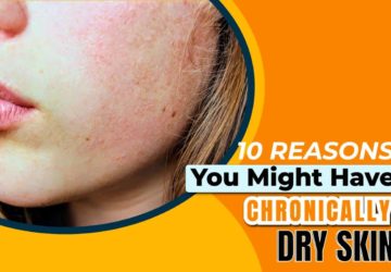 10 Reasons You Might Have Chronically Dry Skin