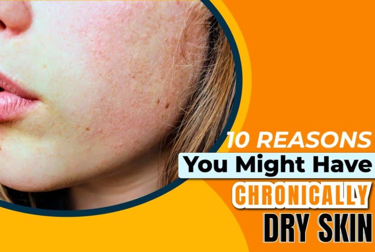 10 Reasons You Might Have Chronically Dry Skin