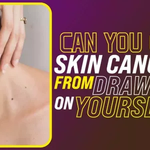 Can You Get Skin Cancer From Drawing On Yourself