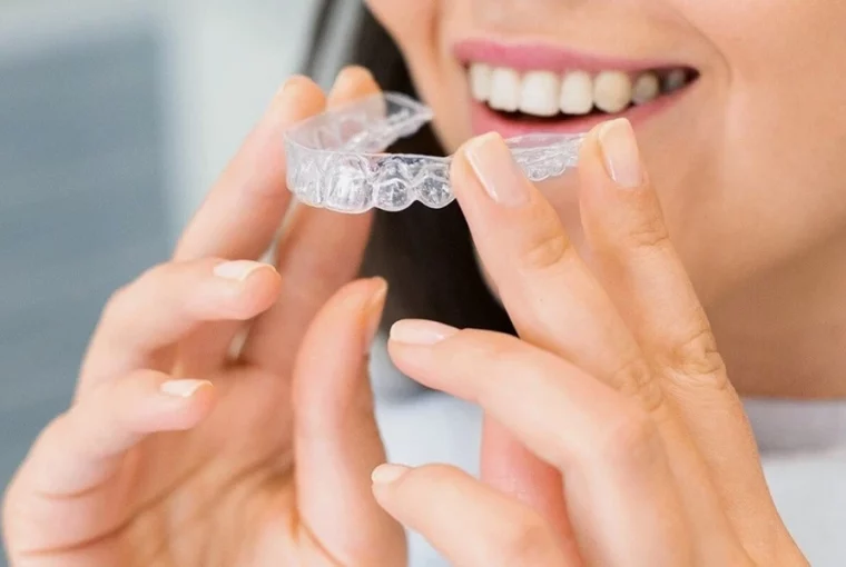 How Invisalign Can Improve Your Life