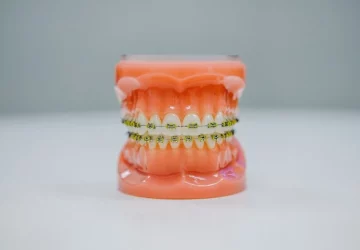 Are Permanent Retainers Safe