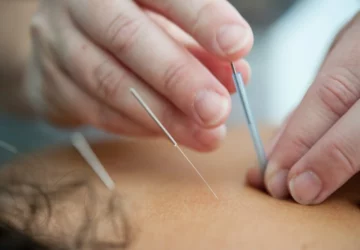 How To Find The Best Acupuncturist In Pennsylvania