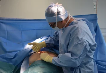 How One Doctor is Changing The Liposuction Procedure