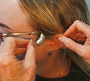 Impacted Earwax