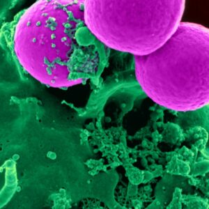 Understanding Recurrent Yeast Infections And Breakthrough Treatments