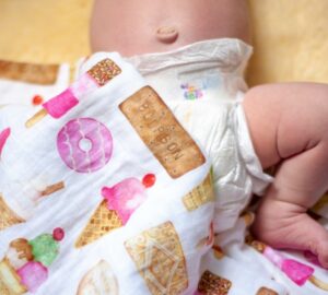 Why Would An Adult Belly Button Bleed