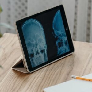 The Symptoms Of TBIs You Should Look Out For